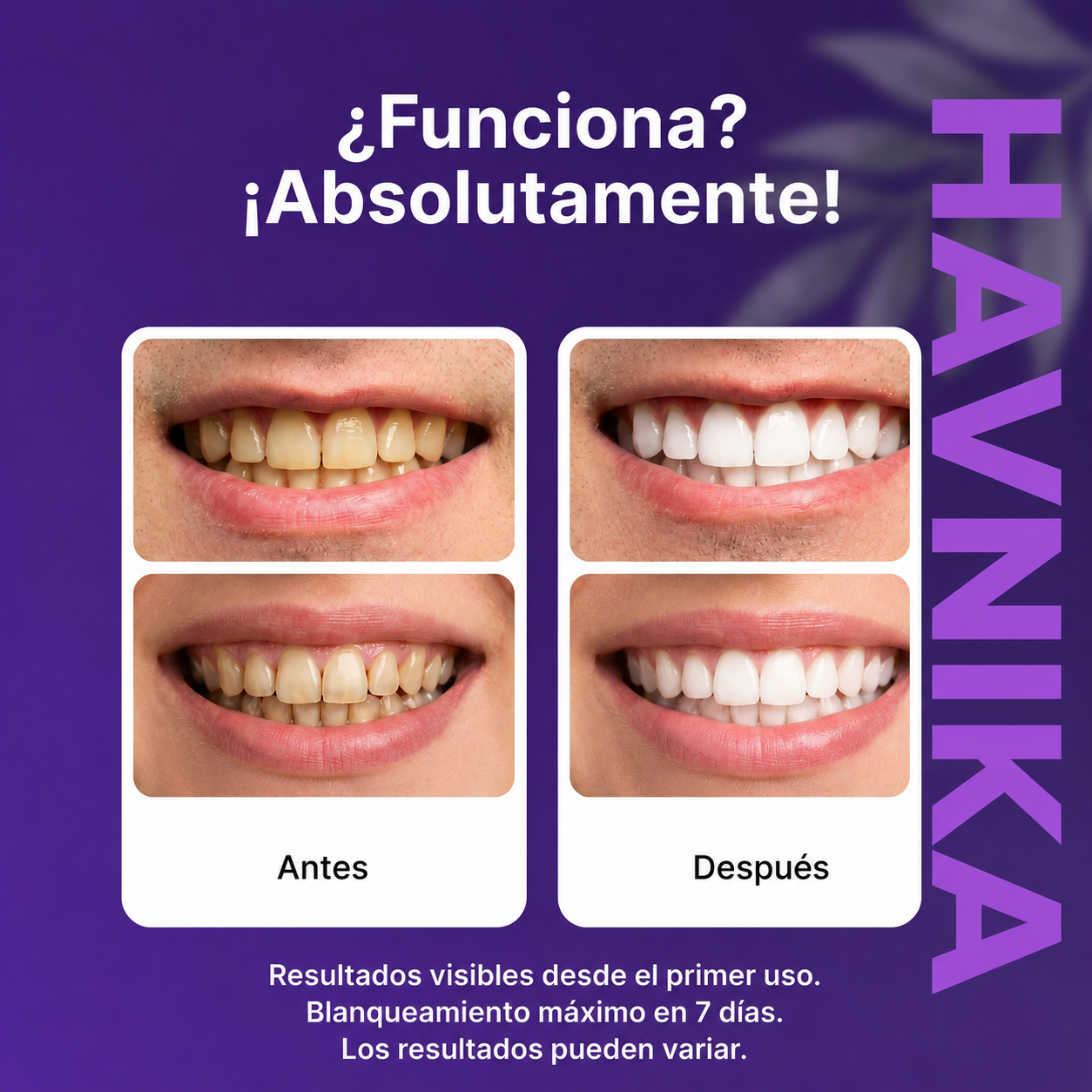 Havnika™ Purple Teeth Whitening Strips