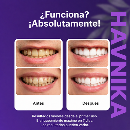 Havnika™ Purple Teeth Whitening Strips